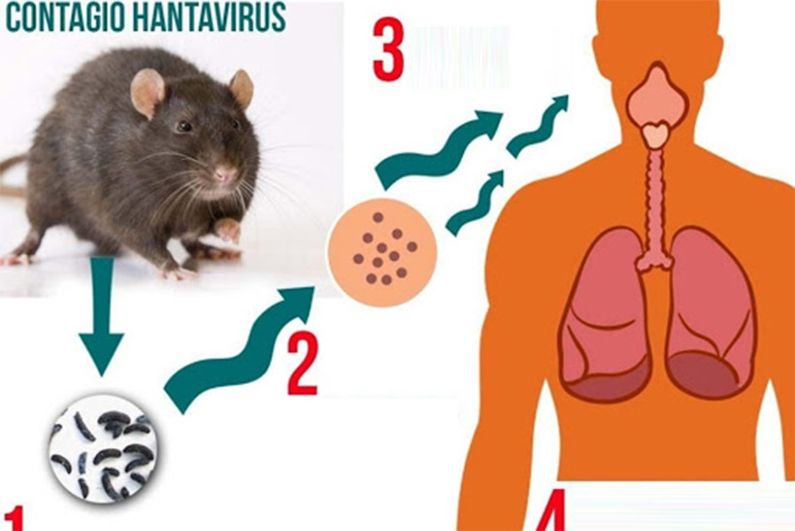 How Long Does Hantavirus Live On Surfaces